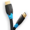 Vention HDMI Cable 3Meter Black – VEN-AACBI